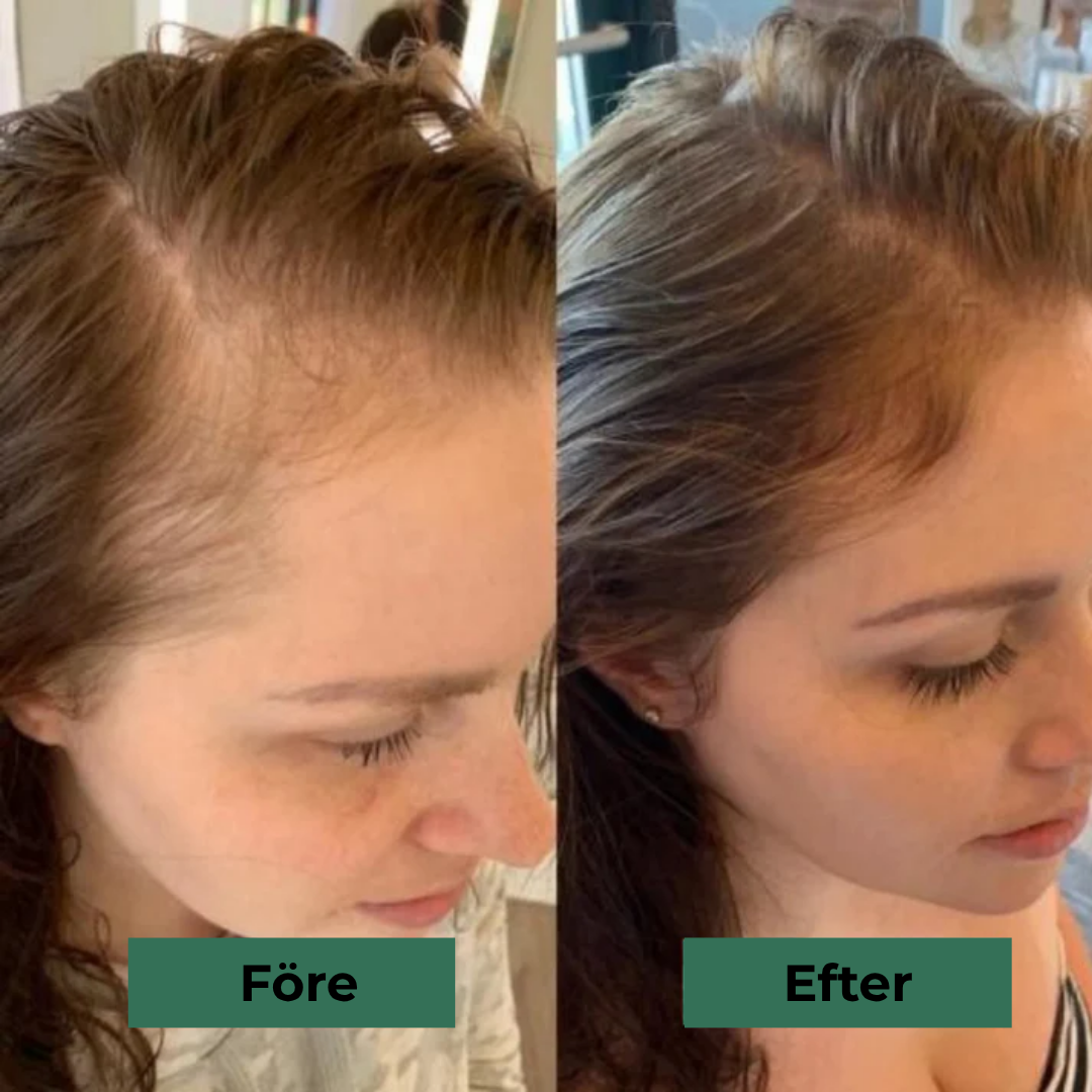 LumiStrand™ | Återfå fylligt, livfullt hår – helt naturligt och utan bekymmer